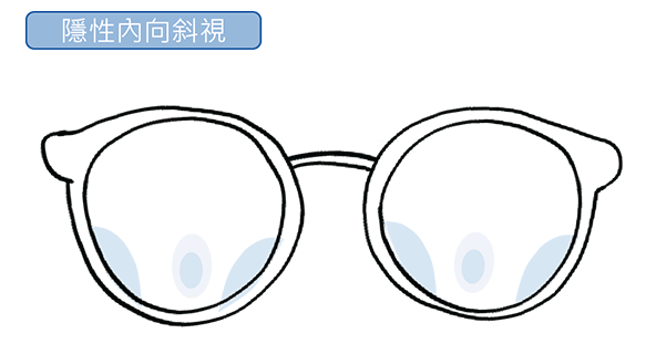 Puyi Optical_Myopia Management_9